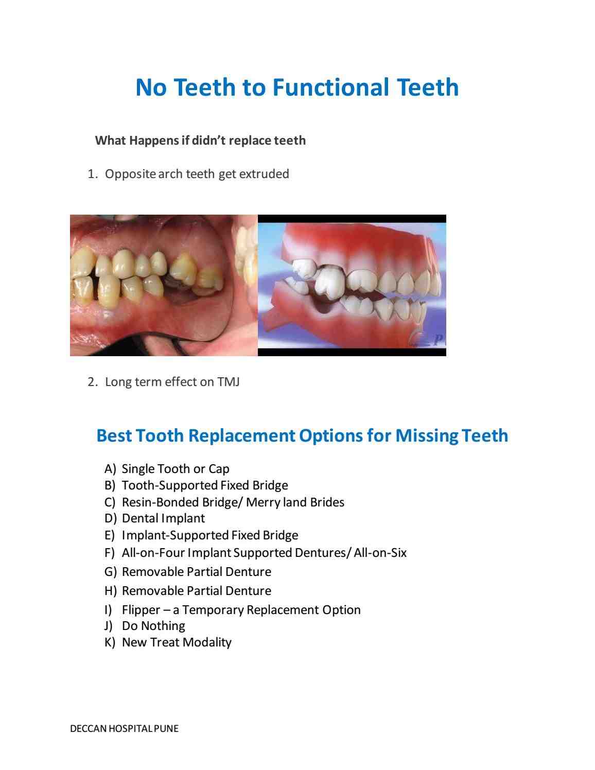 How long does dental implant last?