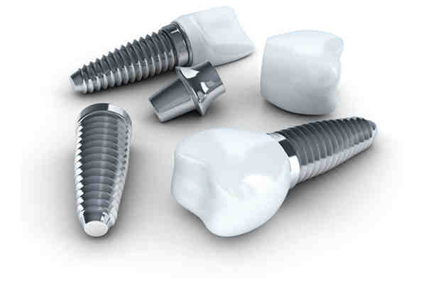 How long does the pain last after a dental implant?