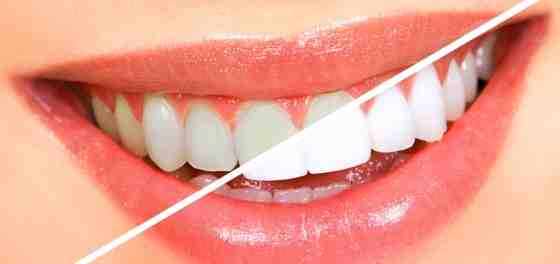 How many cosmetic dentists are in the US?