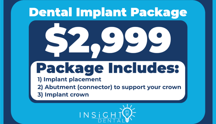 How many months dental implants
