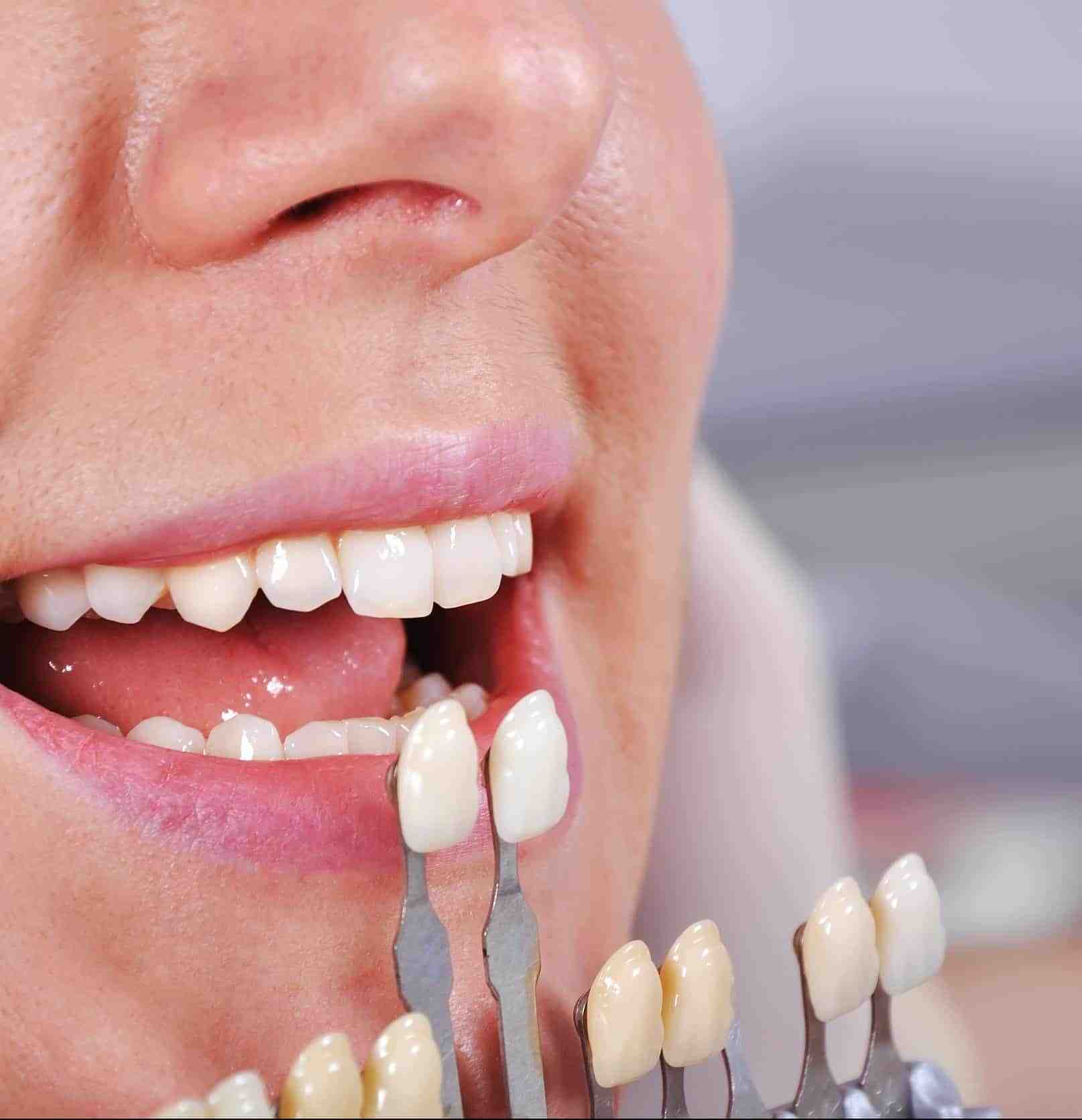 Cosmetic dentistry cheap tulsa Dental News Network