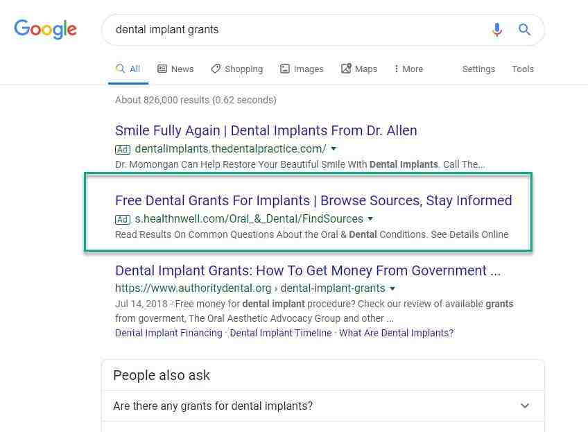 What is the best dental insurance for implants Dental News Network