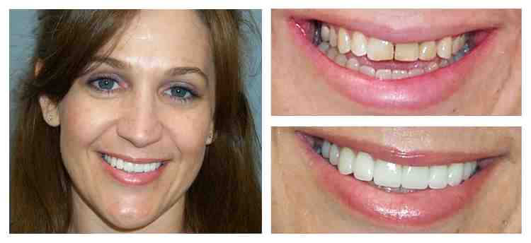 How much does cosmetic dental work cost?