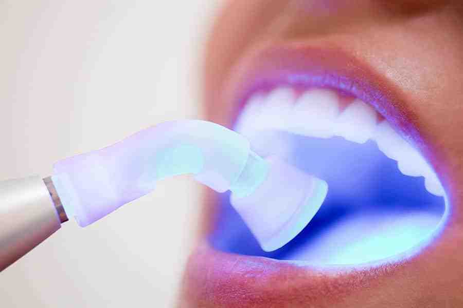 How much does cosmetic dental work cost?