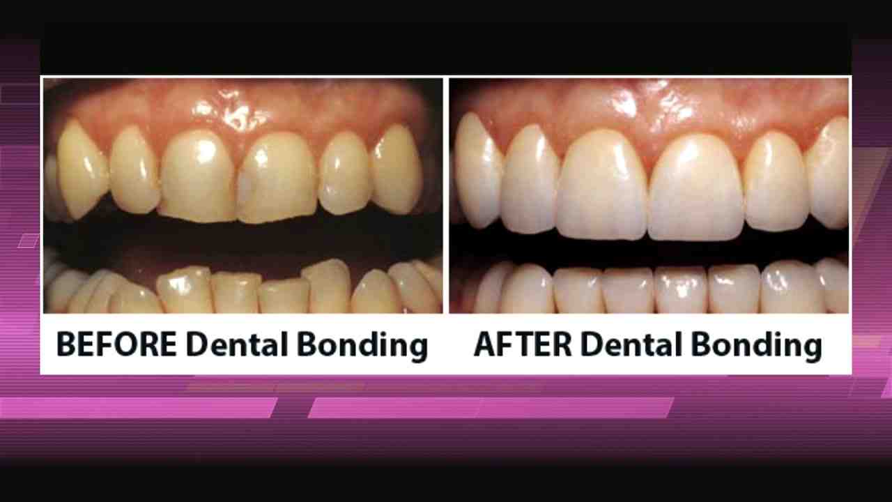 cosmetic-dentistry-cosmetic-evaluation-cost-dental-news-network