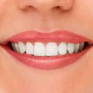 How much is cosmetic dentistry in South Africa?