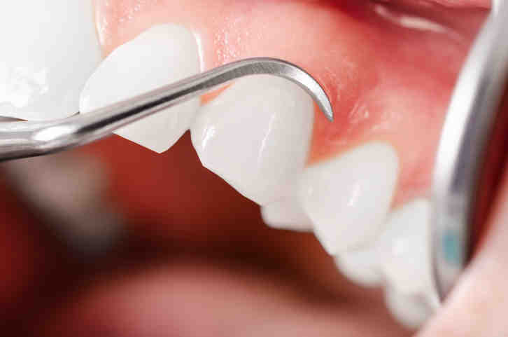 How much is cosmetic dentistry in South Africa?