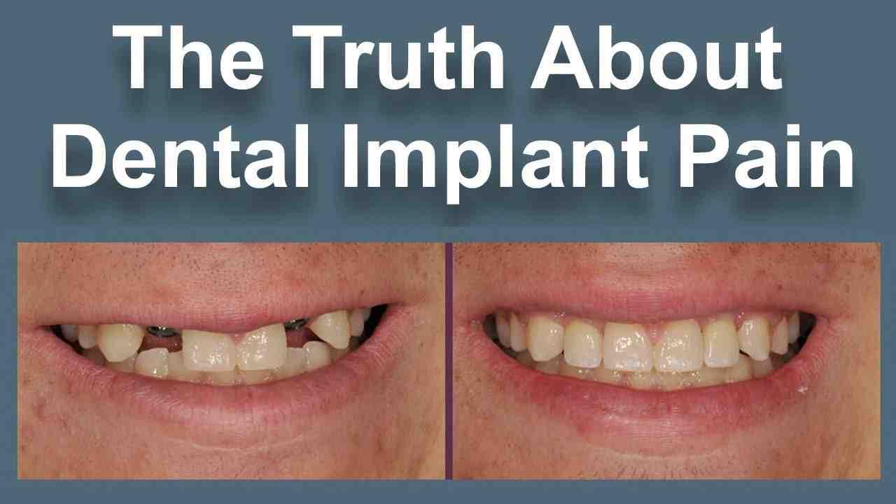 Is dental implant procedure painful?