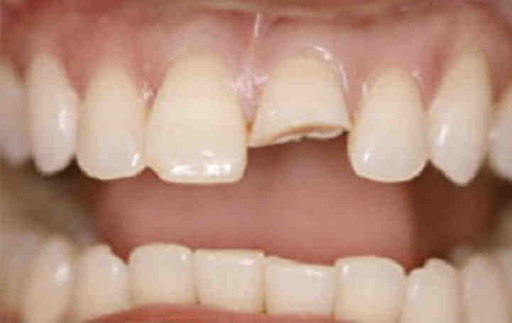 Is the cosmetic dentistry grant program legit?