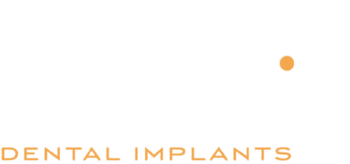 Should I get a second opinion for dental implants?