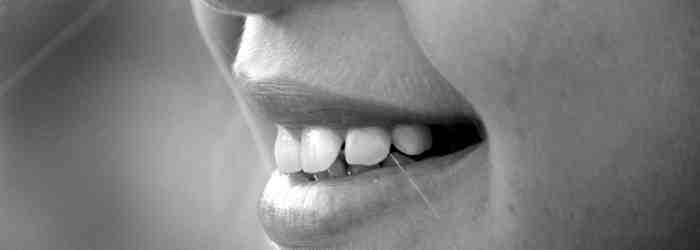 What are the pros and cons of veneers?