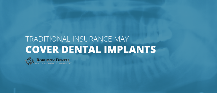 What dental procedures are covered by medical insurance?