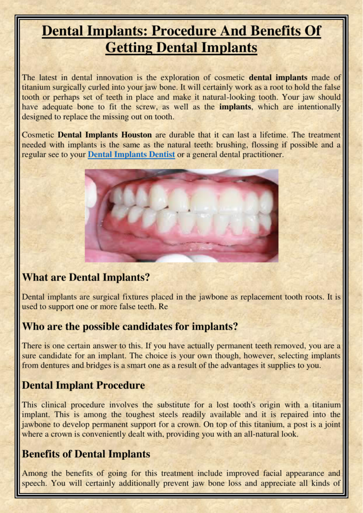 Can you get dental implants if you have bone loss Dental News Network