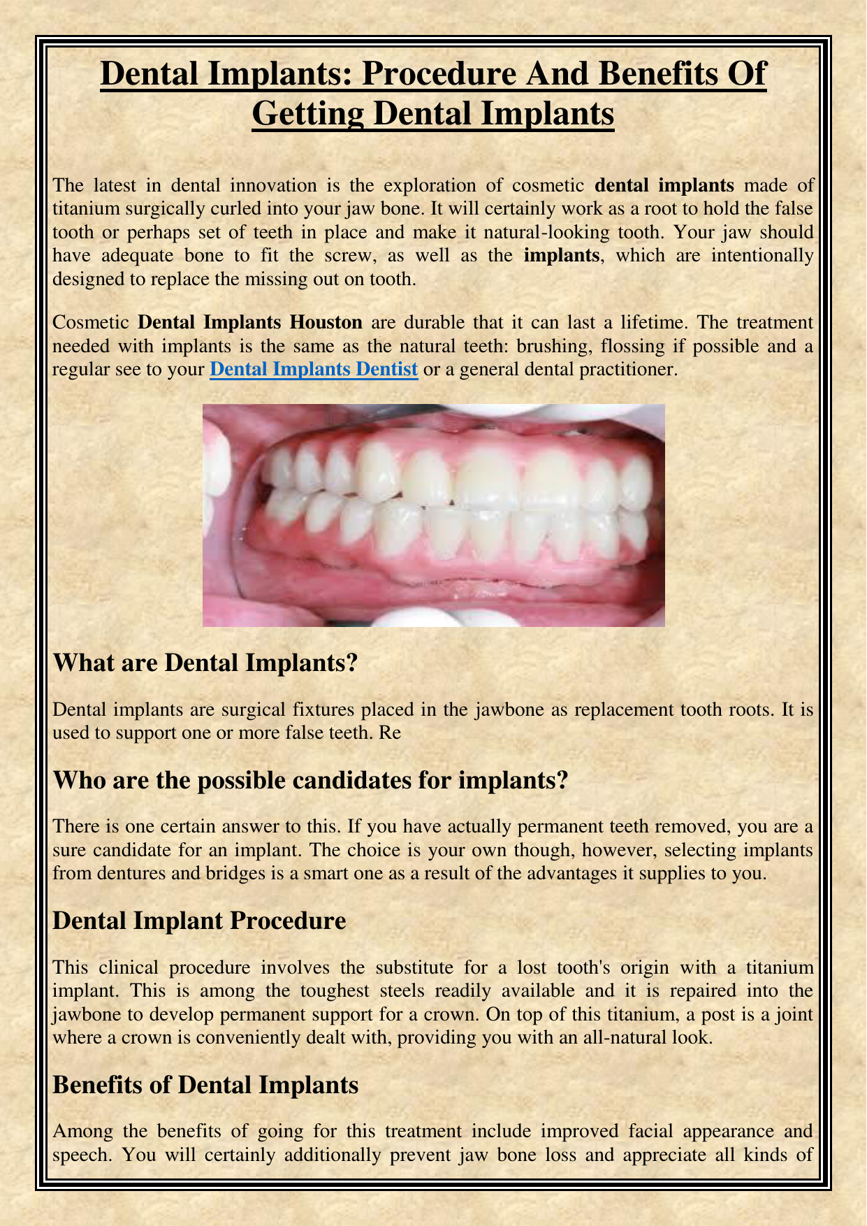 What happens if you don't have enough bones for dental implants?