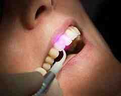 What is the best cosmetic dentistry?