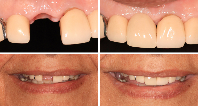 What is the best cosmetic dentistry?