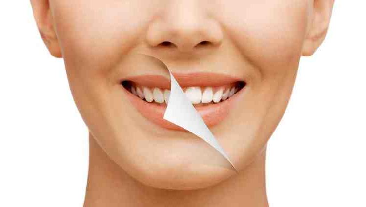 What is the best dental discount plan?