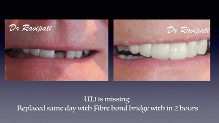 What is the difference between cosmetic dentistry and general dentistry?