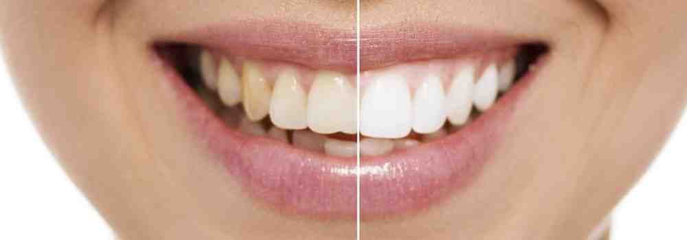 What is the difference between cosmetic dentistry and general dentistry?