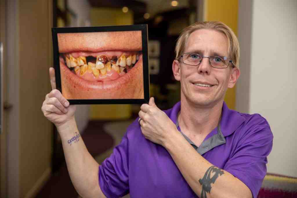 What is the downside of dental implants?