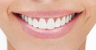 What is the failure rate of dental implants?