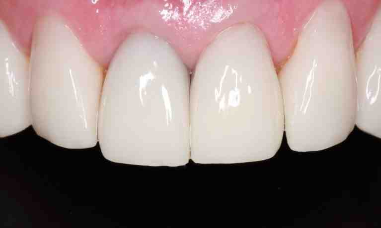 What type of dentist does cosmetic dentistry?