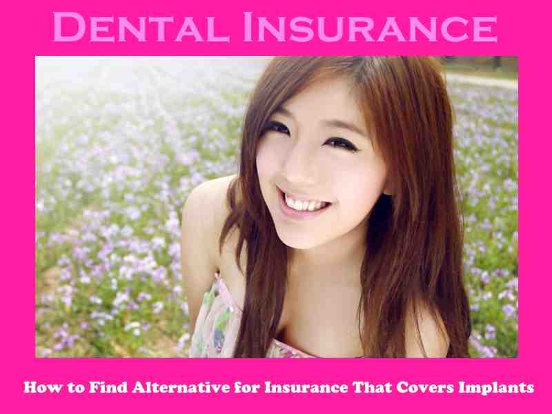 is-there-any-dental-insurance-that-covers-implants-dental-news-network