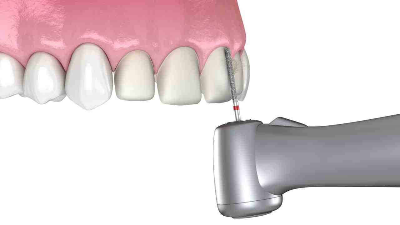 Who is the best cosmetic dentist?