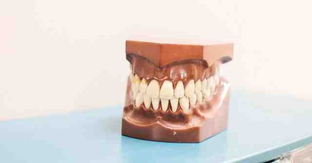 Why dental implants are bad?
