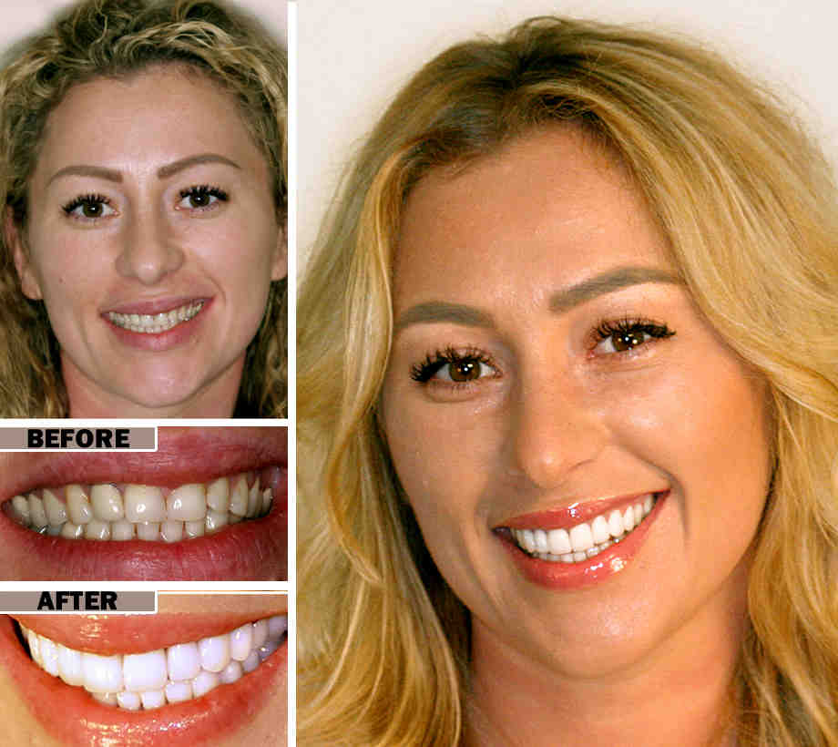 Why is cosmetic dentistry so popular?