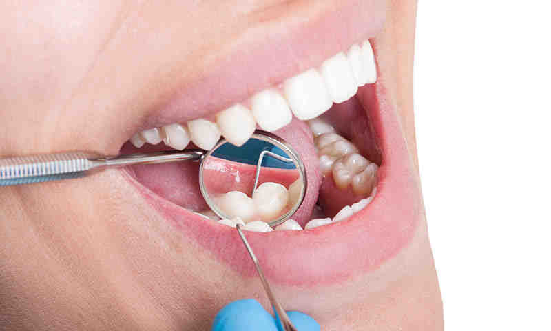 Are dental implant grants real?