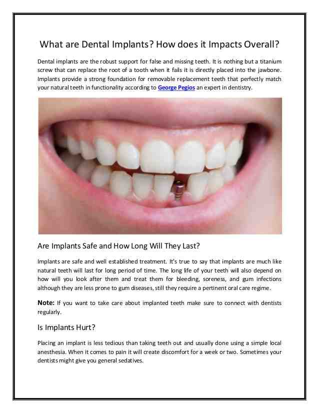 Are dental implants a permanent solution?