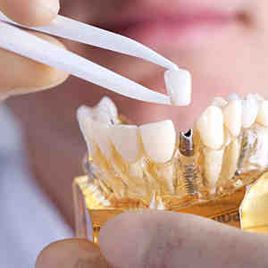 Are mini implants as good as regular implants?