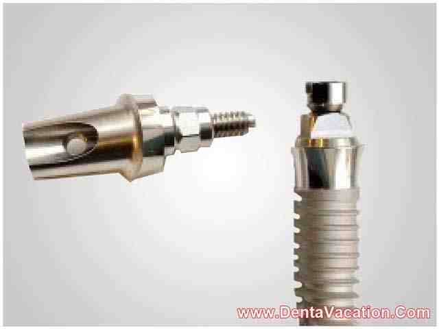 Are veneers cheaper in Mexico?