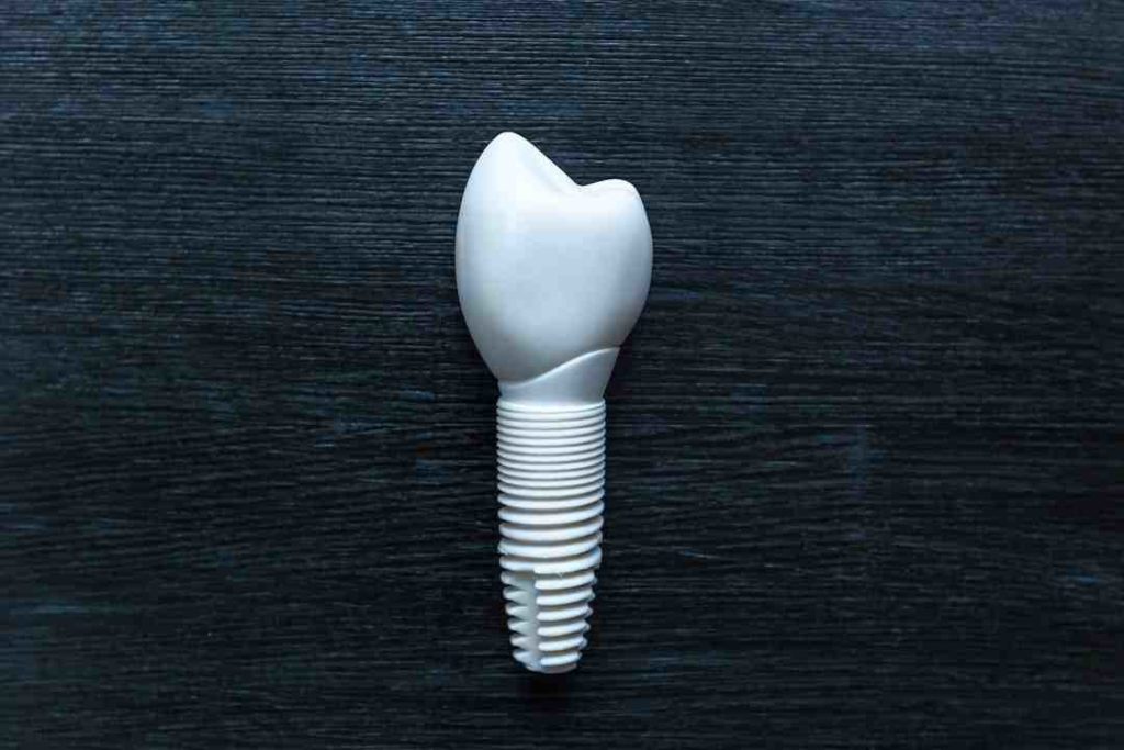 are-dental-implants-toxic-dental-news-network