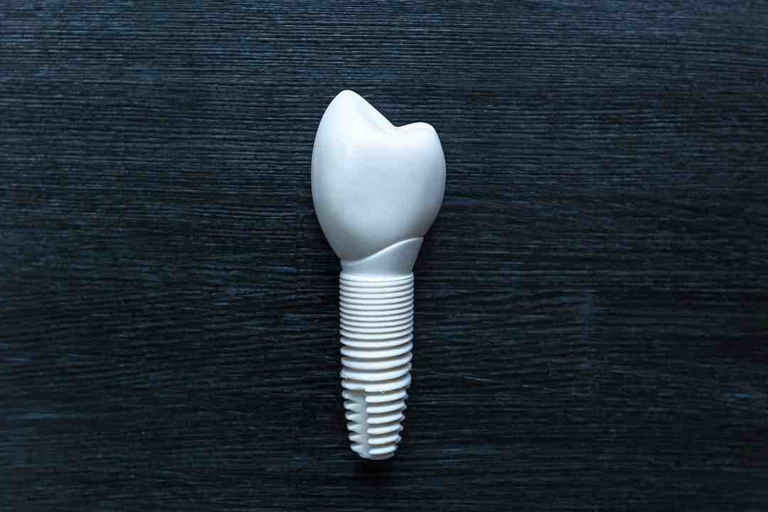 Are dental implants toxic Dental News Network