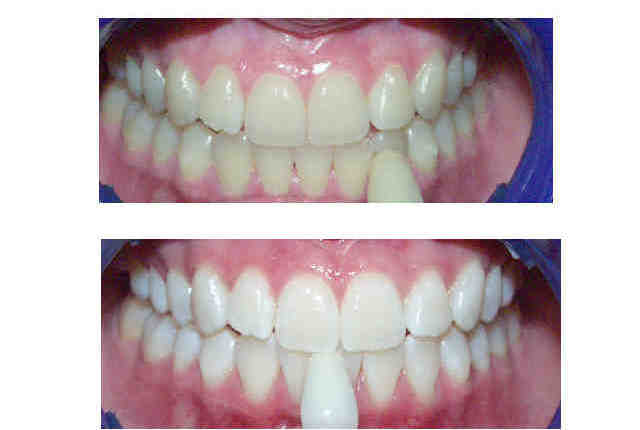 Can you get cosmetic dentistry on the NHS?