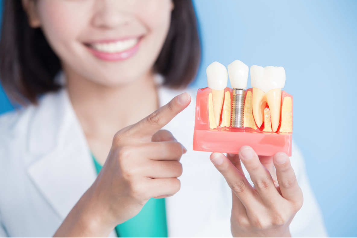 Can you go through metal detectors with dental implants?