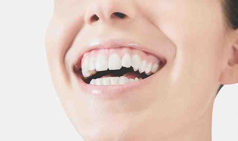 Can you lengthen front teeth?