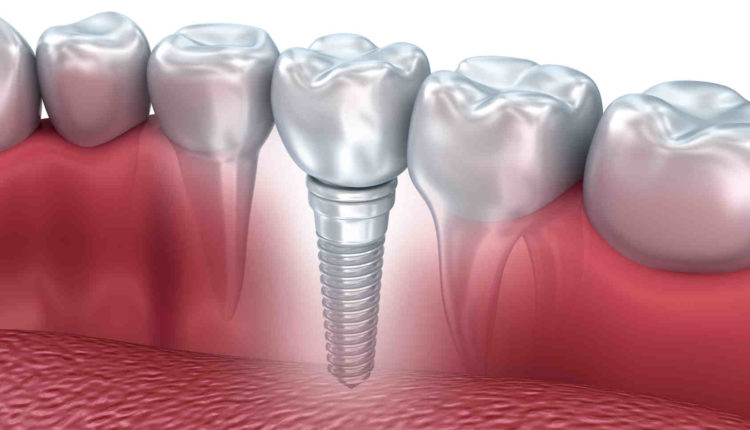 Cosmetic dentistry europe cost