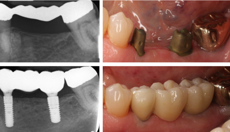 Cosmetic dentistry fort myers