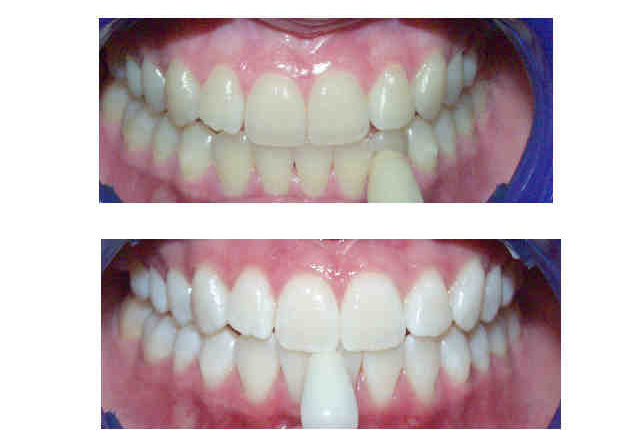 Cosmetic dentistry fort wayne in