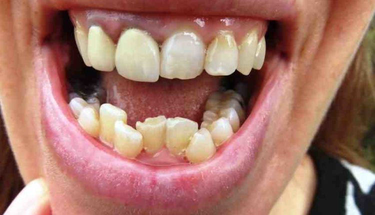 Cosmetic dentistry grant spam