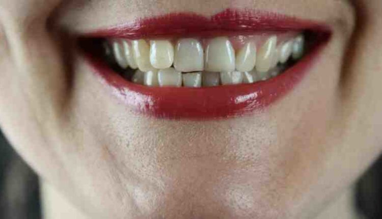 Cosmetic dentistry grants atlanta