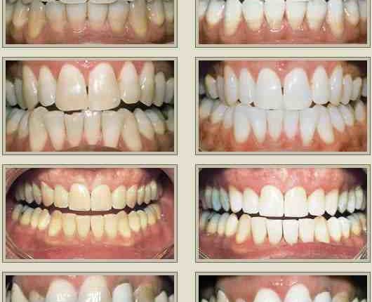 Cosmetic dentistry gravesend