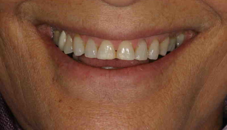 Cosmetic dentistry honolulu