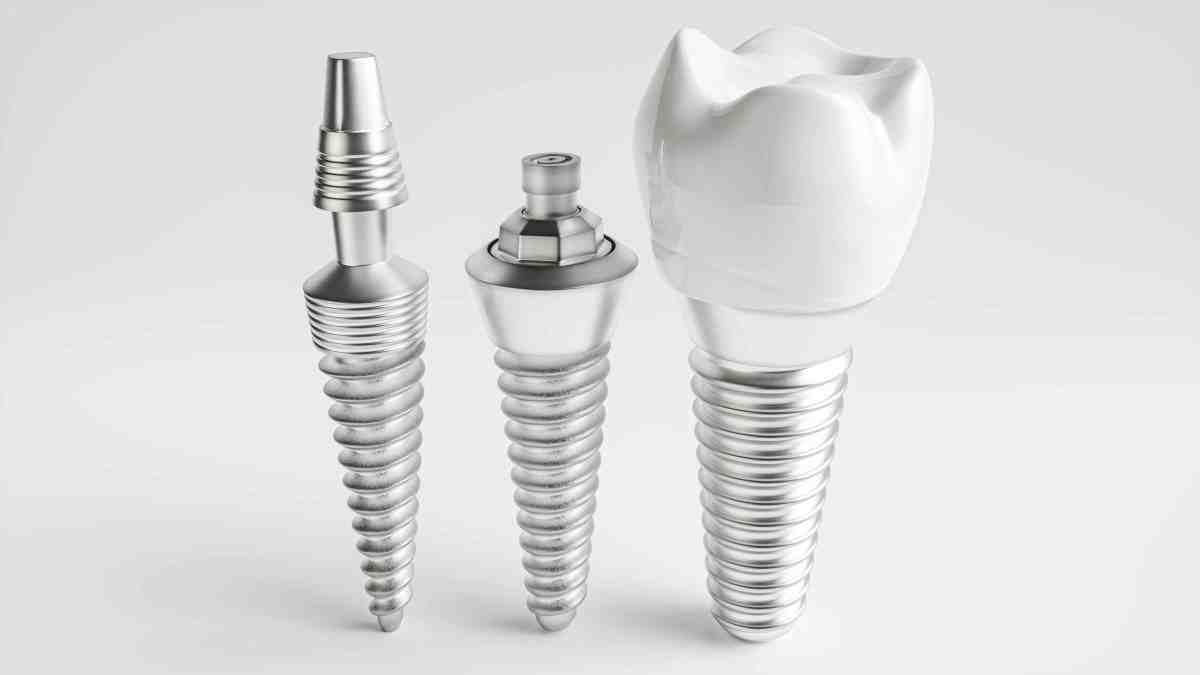 does-healthfirst-cover-dental-implants-dental-news-network