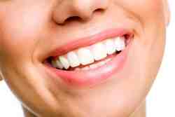 How Much Does a full dental makeover cost?