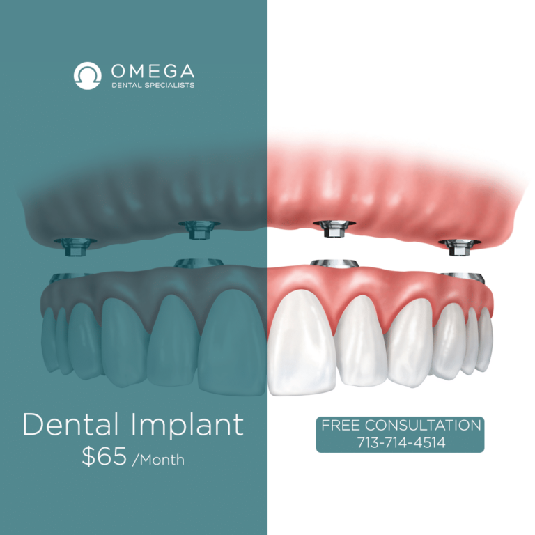 where-to-get-free-dental-implants-dental-news-network