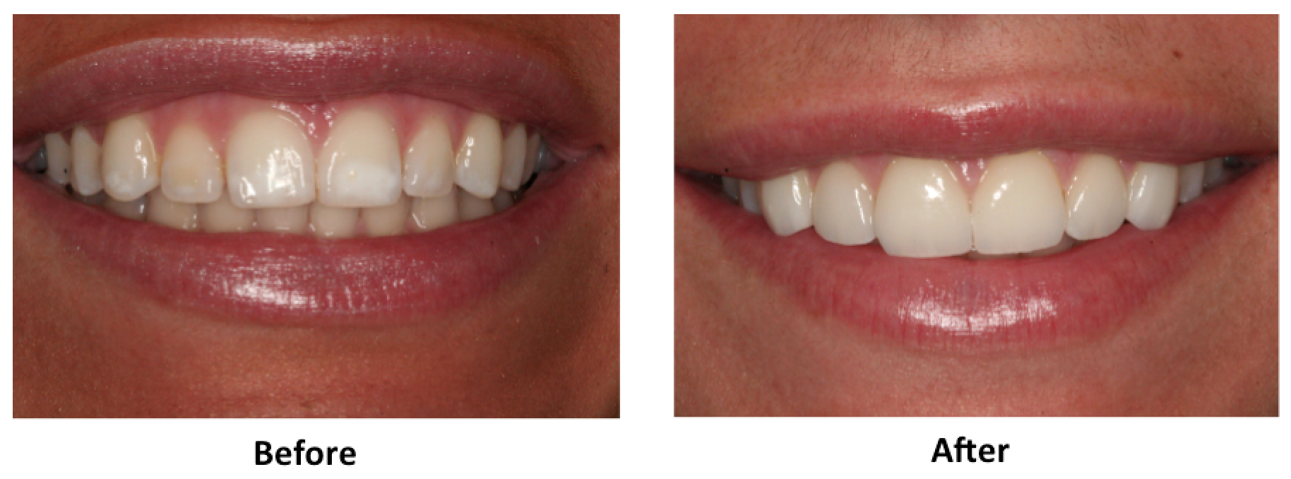 How can I get money to fix my teeth?